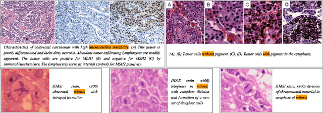 Figure 2 for Multiple Instance Captioning: Learning Representations from Histopathology Textbooks and Articles