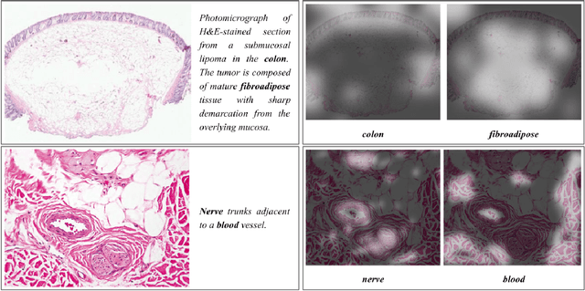 Figure 3 for Multiple Instance Captioning: Learning Representations from Histopathology Textbooks and Articles