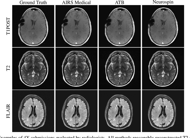 Figure 2 for State-of-the-Art Machine Learning MRI Reconstruction in 2020: Results of the Second fastMRI Challenge