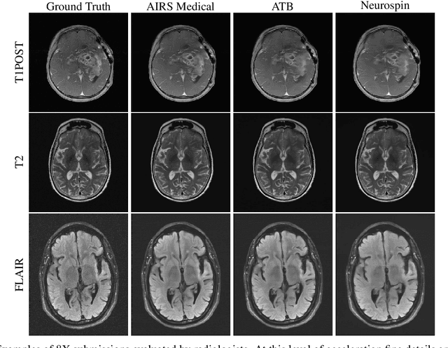 Figure 3 for State-of-the-Art Machine Learning MRI Reconstruction in 2020: Results of the Second fastMRI Challenge