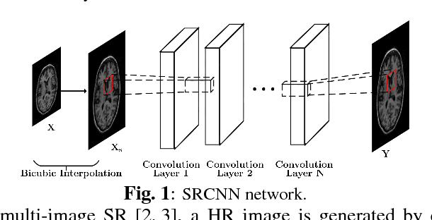 Figure 1 for Deep MR Image Super-Resolution Using Structural Priors