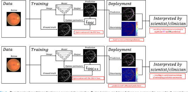 Figure 1 for Calibrating the Dice loss to handle neural network overconfidence for biomedical image segmentation