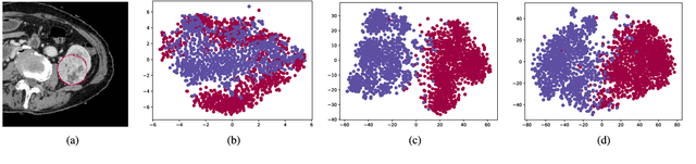 Figure 2 for Crossbar-Net: A Novel Convolutional Network for Kidney Tumor Segmentation in CT Images