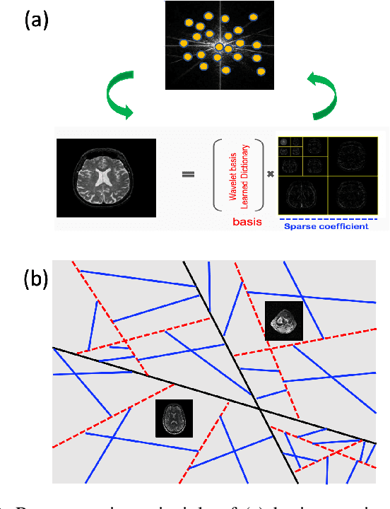 Figure 3 for Geometric Approaches to Increase the Expressivity of Deep Neural Networks for MR Reconstruction