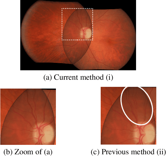 Figure 3 for Registration of retinal images from Public Health by minimising an error between vessels using an affine model with radial distortions