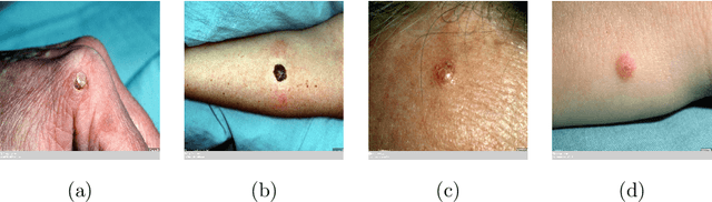 Figure 2 for Artificial Intelligence-Based Image Classification for Diagnosis of Skin Cancer: Challenges and Opportunities
