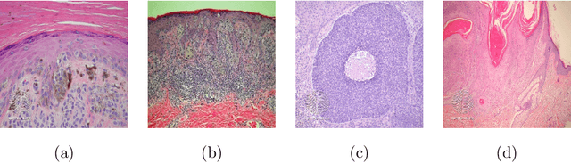 Figure 3 for Artificial Intelligence-Based Image Classification for Diagnosis of Skin Cancer: Challenges and Opportunities