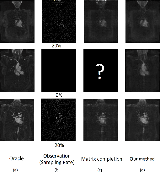 Figure 1 for Convolutional Imputation of Matrix Networks