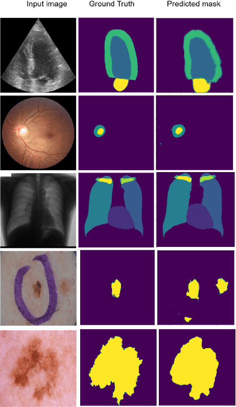 Figure 4 for FixMatchSeg: Fixing FixMatch for Semi-Supervised Semantic Segmentation