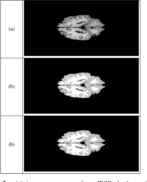 Figure 4 for hidden markov random fields and cuckoo search method for medical image segmentation