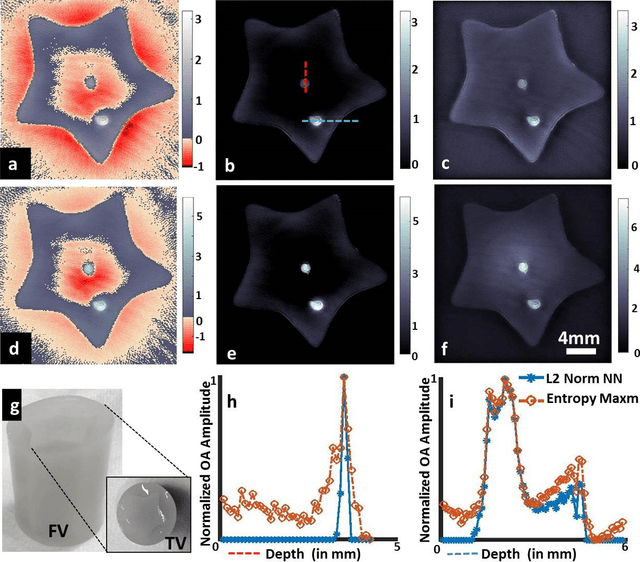 Figure 2 for Maximum entropy based non-negative optoacoustic tomographic image reconstruction