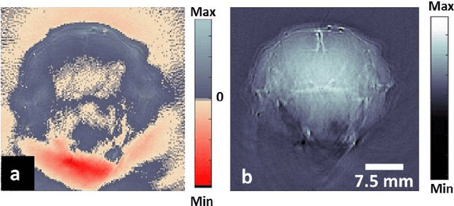 Figure 4 for Maximum entropy based non-negative optoacoustic tomographic image reconstruction