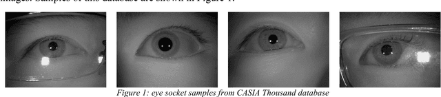 Figure 1 for An End to End Deep Neural Network for Iris Segmentation in Unconstraint Scenarios