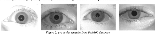 Figure 3 for An End to End Deep Neural Network for Iris Segmentation in Unconstraint Scenarios