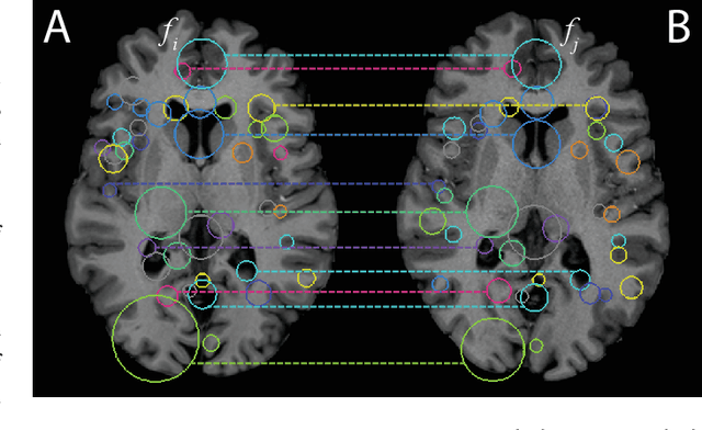 Figure 1 for Efficient Pairwise Neuroimage Analysis using the Soft Jaccard Index and 3D Keypoint Sets