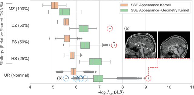 Figure 3 for Efficient Pairwise Neuroimage Analysis using the Soft Jaccard Index and 3D Keypoint Sets