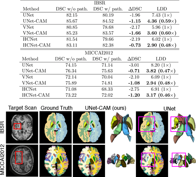 Figure 4 for Atlas-aware ConvNetfor Accurate yet Robust Anatomical Segmentation