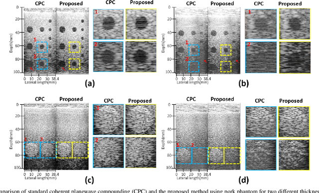 Figure 4 for Phase Aberration Robust Beamformer for Planewave US Using Self-Supervised Learning