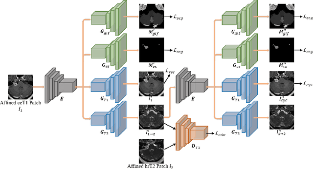 Figure 3 for Unsupervised Cross-Modality Domain Adaptation for Vestibular Schwannoma Segmentation and Koos Grade Prediction based on Semi-Supervised Contrastive Learning