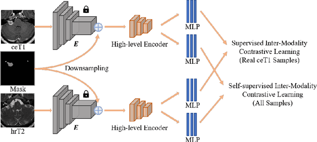 Figure 4 for Unsupervised Cross-Modality Domain Adaptation for Vestibular Schwannoma Segmentation and Koos Grade Prediction based on Semi-Supervised Contrastive Learning
