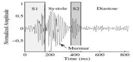 Figure 1 for A Visual Domain Transfer Learning Approach for Heartbeat Sound Classification