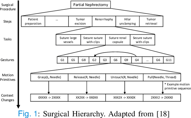 Figure 1 for COMPASS: A Formal Framework and Aggregate Dataset for Generalized Surgical Procedure Modeling