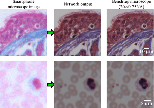 Figure 3 for Toward a Thinking Microscope: Deep Learning in Optical Microscopy and Image Reconstruction