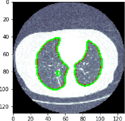 Figure 2 for Distant Domain Transfer Learning for Medical Imaging