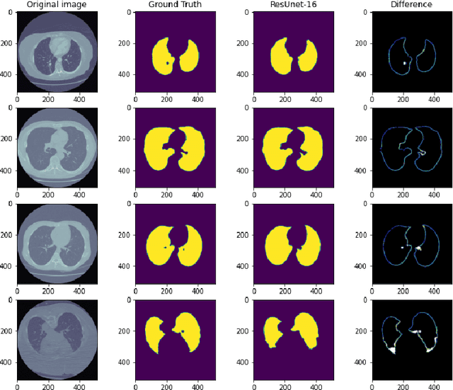 Figure 4 for Distant Domain Transfer Learning for Medical Imaging