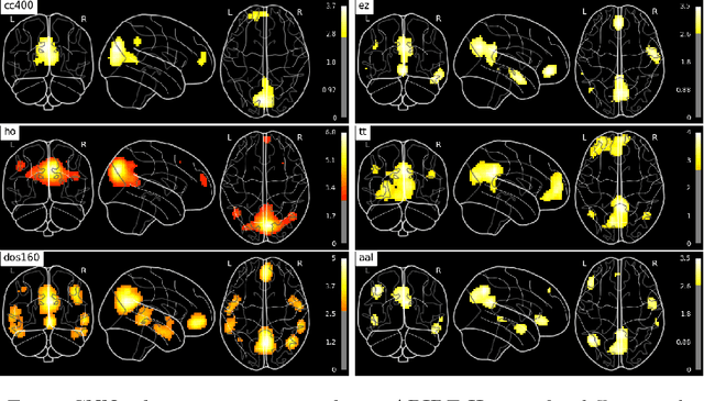 Figure 4 for 3D Convolutional Neural Networks for Classification of Functional Connectomes