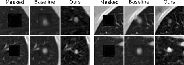 Figure 3 for Decompose to manipulate: Manipulable Object Synthesis in 3D Medical Images with Structured Image Decomposition