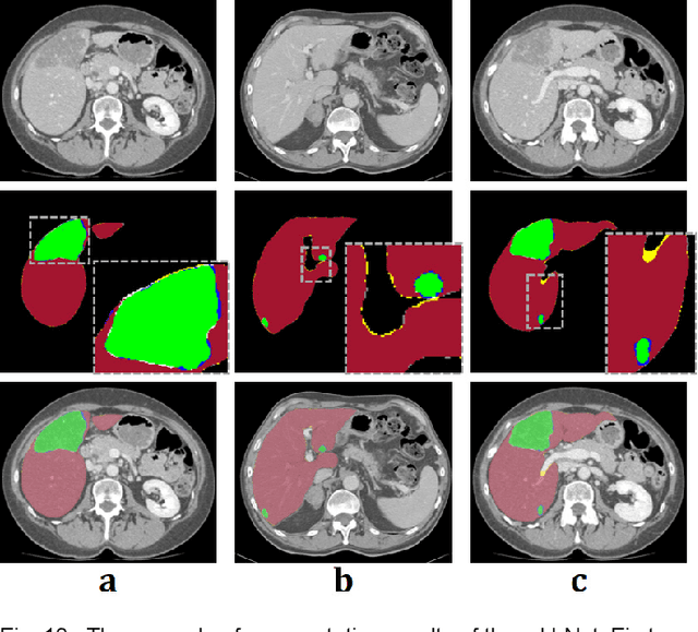 Figure 2 for Modified U-Net  with Incorporation of Object-Dependent High Level Features for Improved Liver and Liver-Tumor Segmentation in CT Images