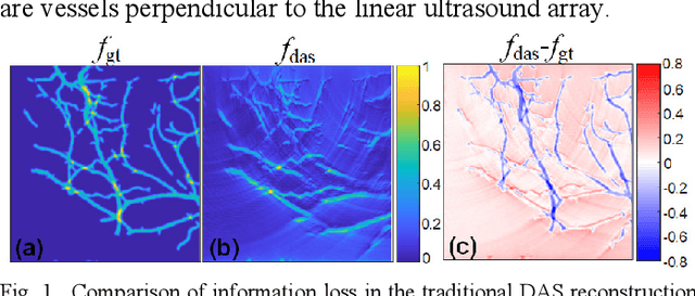Figure 1 for Y-Net: A Hybrid Deep Learning Reconstruction Framework for Photoacoustic Imaging in vivo