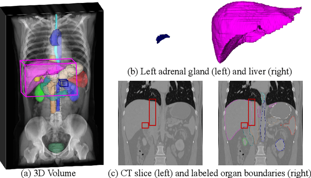 Figure 1 for Boundary-Aware Network for Abdominal Multi-Organ Segmentation