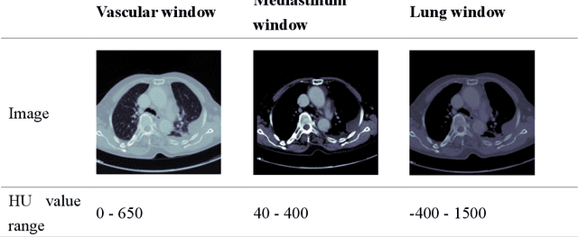 Figure 2 for Detecting Pulmonary Embolism from Computed Tomography Using Convolutional Neural Network