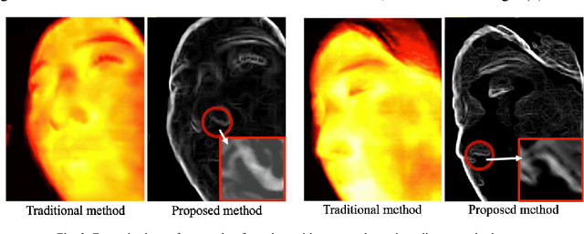 Figure 3 for Robust tracking of respiratory rate in high-dynamic range scenes using mobile thermal imaging