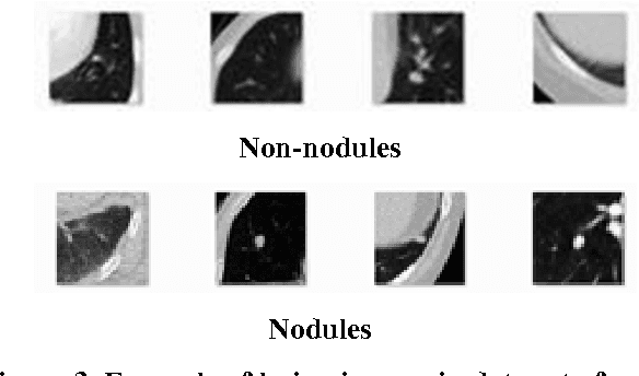Figure 4 for Cascaded Neural Networks with Selective Classifiers and its evaluation using Lung X-ray CT Images