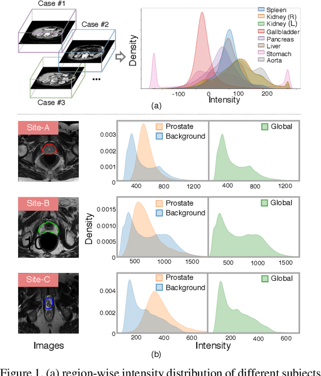 Figure 1 for DualNorm-UNet: Incorporating Global and Local Statistics for Robust Medical Image Segmentation