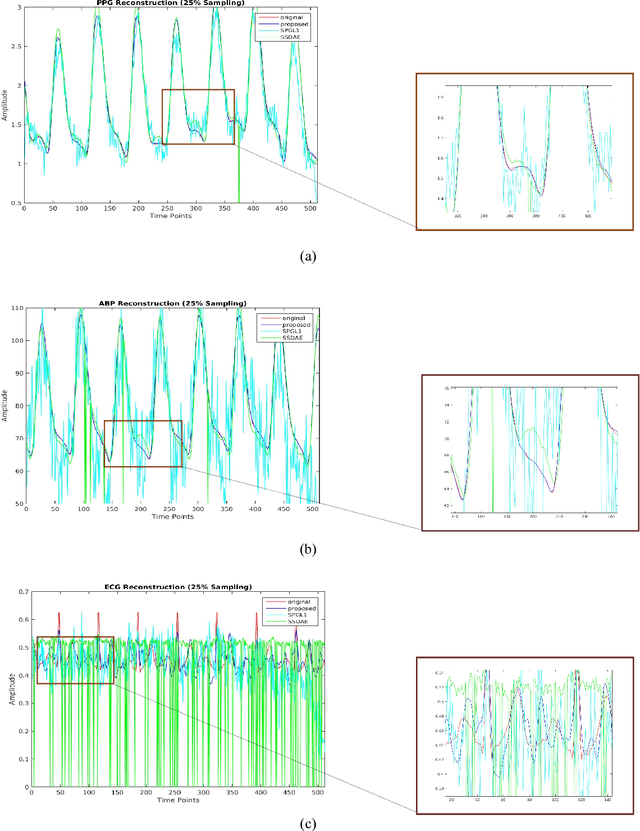 Figure 1 for Coupled Analysis Dictionary Learning to inductively learn inversion: Application to real-time reconstruction of Biomedical signals