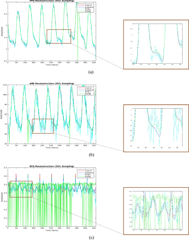 Figure 2 for Coupled Analysis Dictionary Learning to inductively learn inversion: Application to real-time reconstruction of Biomedical signals