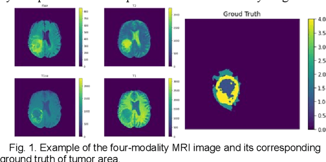 Figure 1 for A Performance-Consistent and Computation-Efficient CNN System for High-Quality Automated Brain Tumor Segmentation