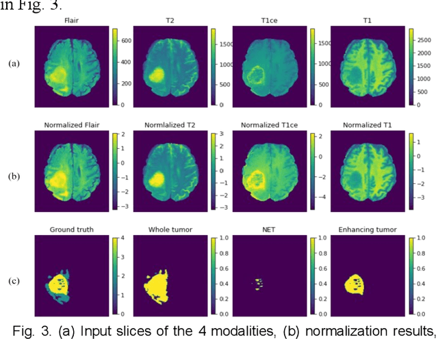 Figure 3 for A Performance-Consistent and Computation-Efficient CNN System for High-Quality Automated Brain Tumor Segmentation