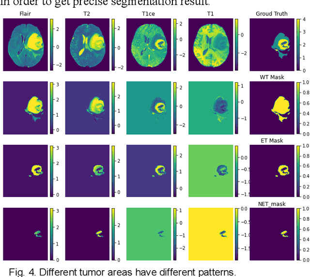 Figure 4 for A Performance-Consistent and Computation-Efficient CNN System for High-Quality Automated Brain Tumor Segmentation