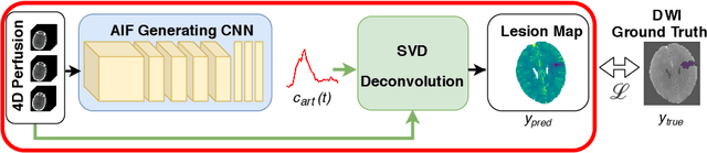 Figure 1 for Differentiable Deconvolution for Improved Stroke Perfusion Analysis