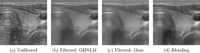 Figure 1 for Speckle2Speckle: Unsupervised Learning of Ultrasound Speckle Filtering Without Clean Data