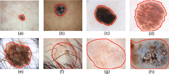 Figure 1 for Boundary-aware Transformers for Skin Lesion Segmentation