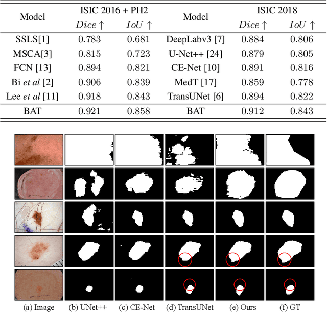 Figure 4 for Boundary-aware Transformers for Skin Lesion Segmentation