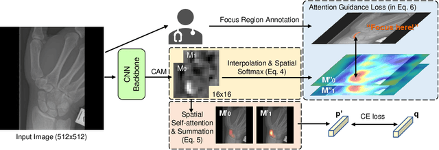 Figure 1 for CNN Attention Guidance for Improved Orthopedics Radiographic Fracture Classification