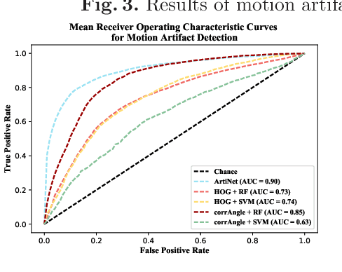 Figure 3 for Motion Artifact Detection in Confocal Laser Endomicroscopy Images
