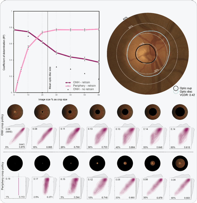 Figure 2 for Glaucoma detection beyond the optic disc: The importance of the peripapillary region using explainable deep learning